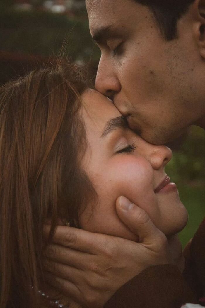 aethetics forehead kiss images full hd